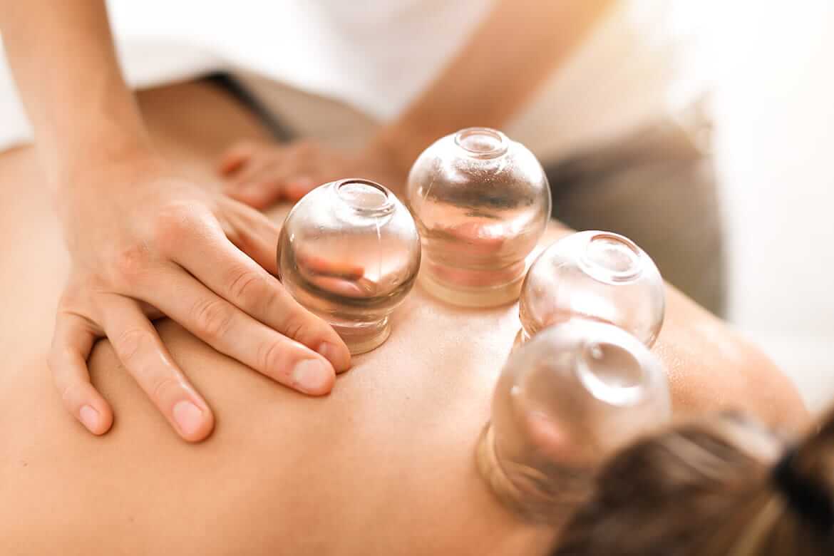 Although cupping looks painful it is totally pain free